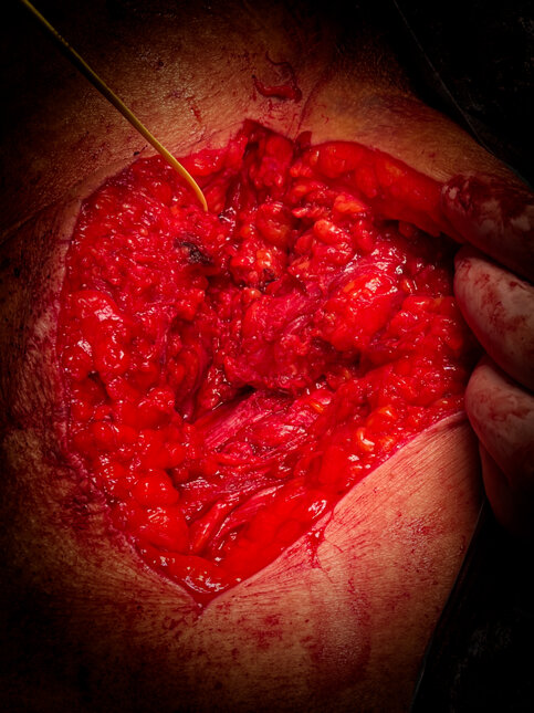 img_1366.jpeg img_1366.jpeg