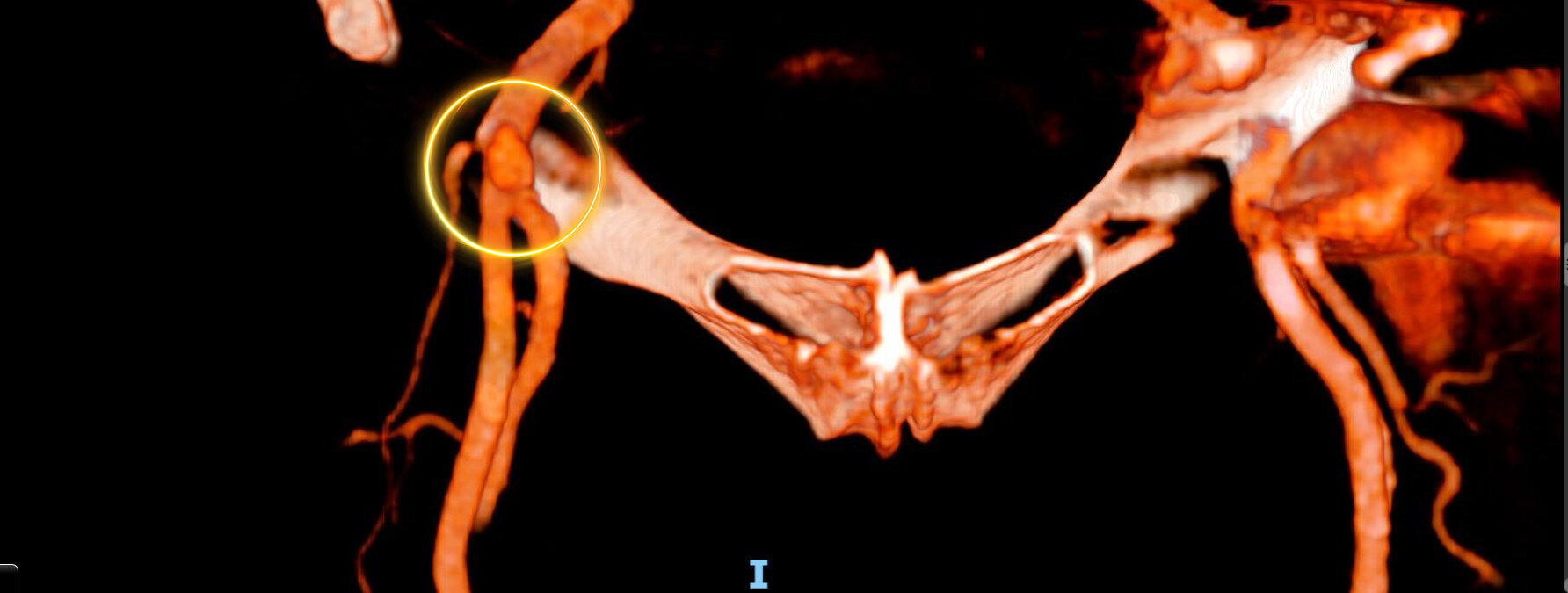 img_1549.jpeg img_1549.jpeg