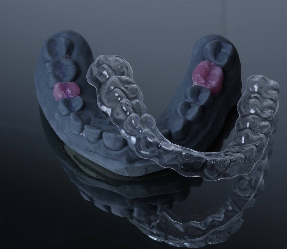 allineatore.jpeg allineatore.jpeg