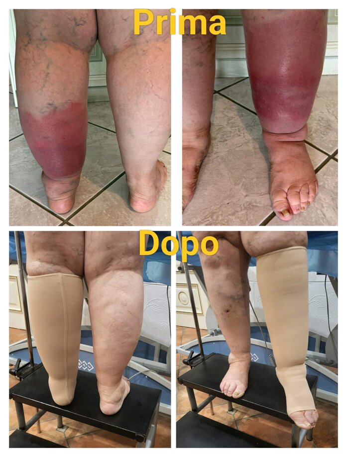 21b0ca408ab98a4de09a7830bd66a16fbd771322