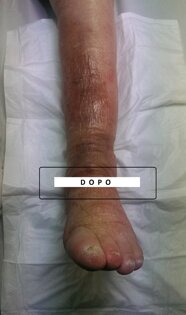 7ec6a3d99742c1488b661cd9d39f4051011ef451