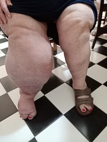 adda55f74ac3887dad0430aa369c51c818855e00