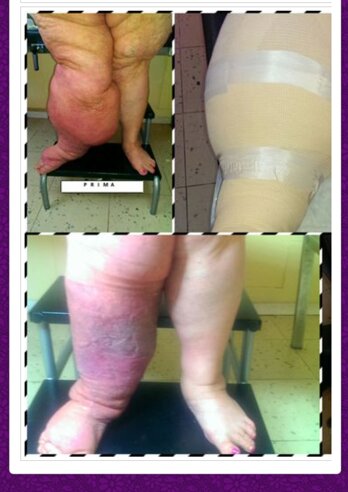 b8c2028d3bb006afee47fb12f82ae4467b4fc977