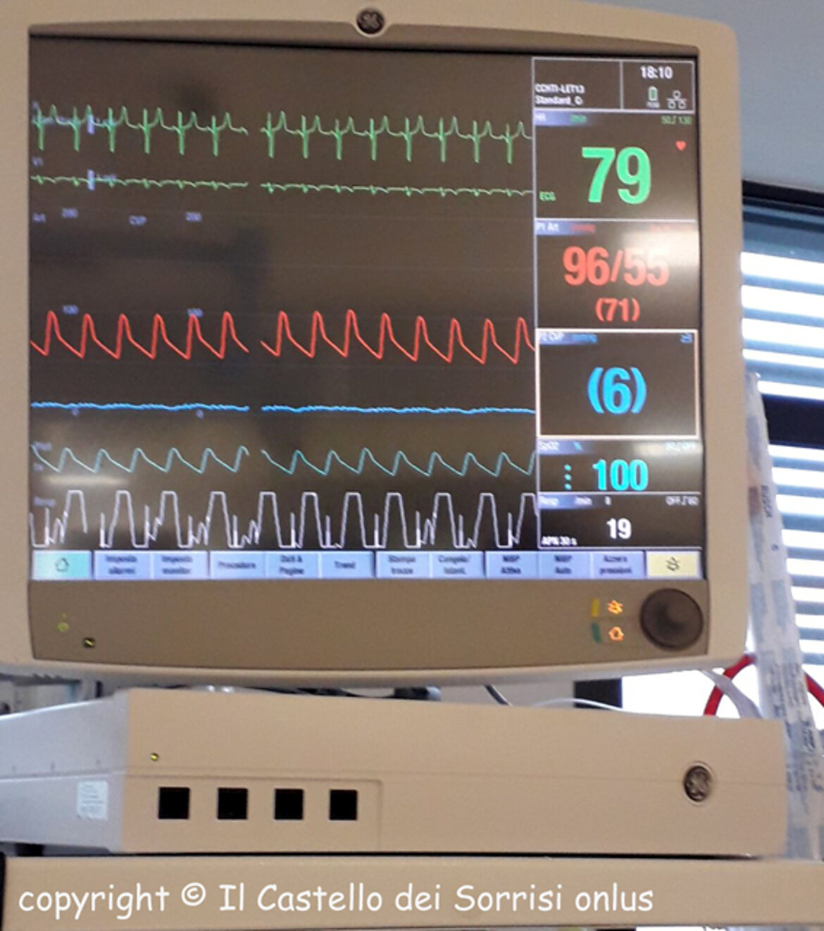 100% ... tutta un'altra aria !!! 100% ... tutta un'altra aria !!!