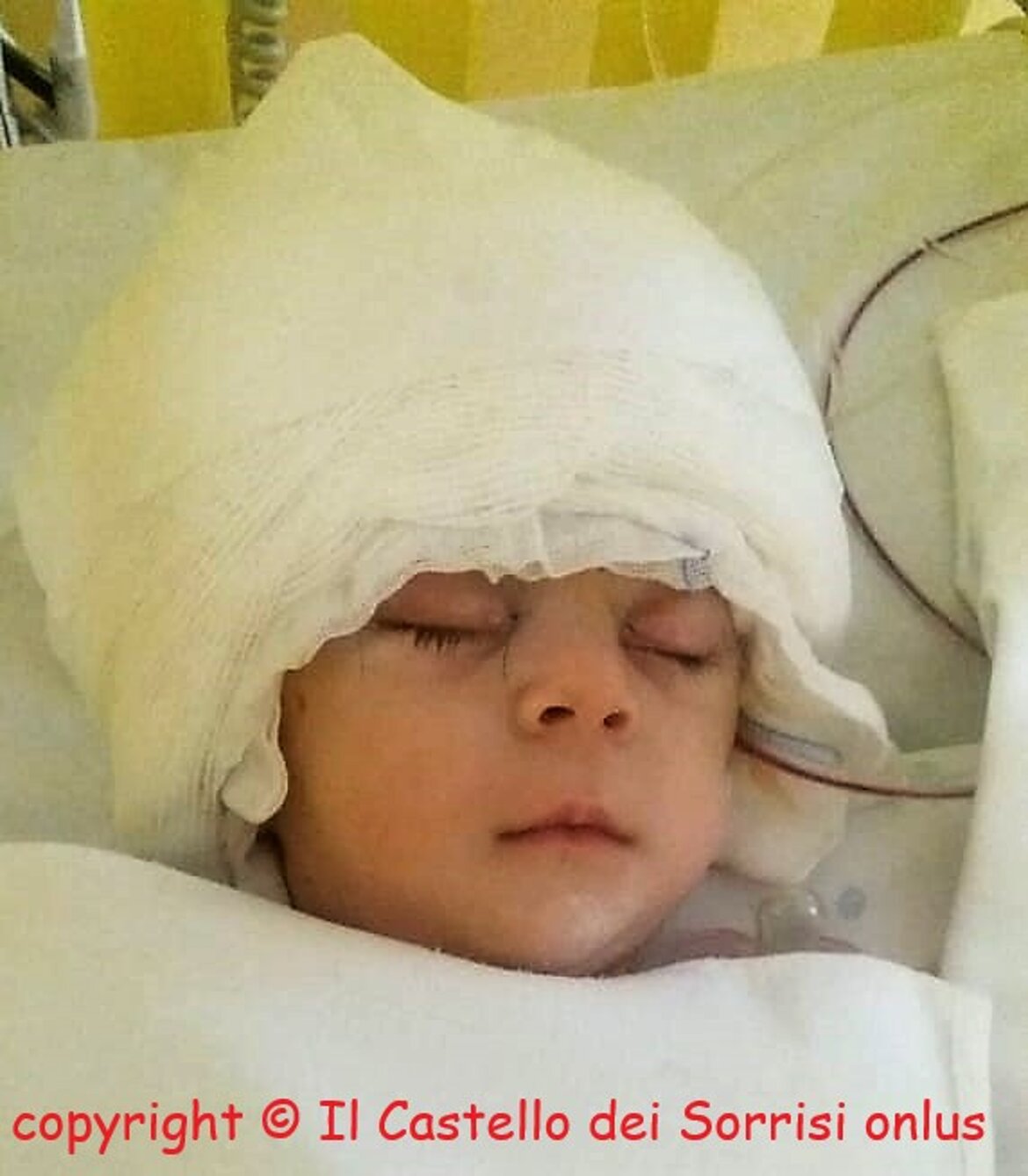 intervento appena terminato !!! intervento appena terminato !!!