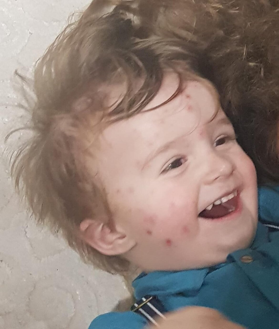 Febbri ricorrenti Febbri ricorrenti