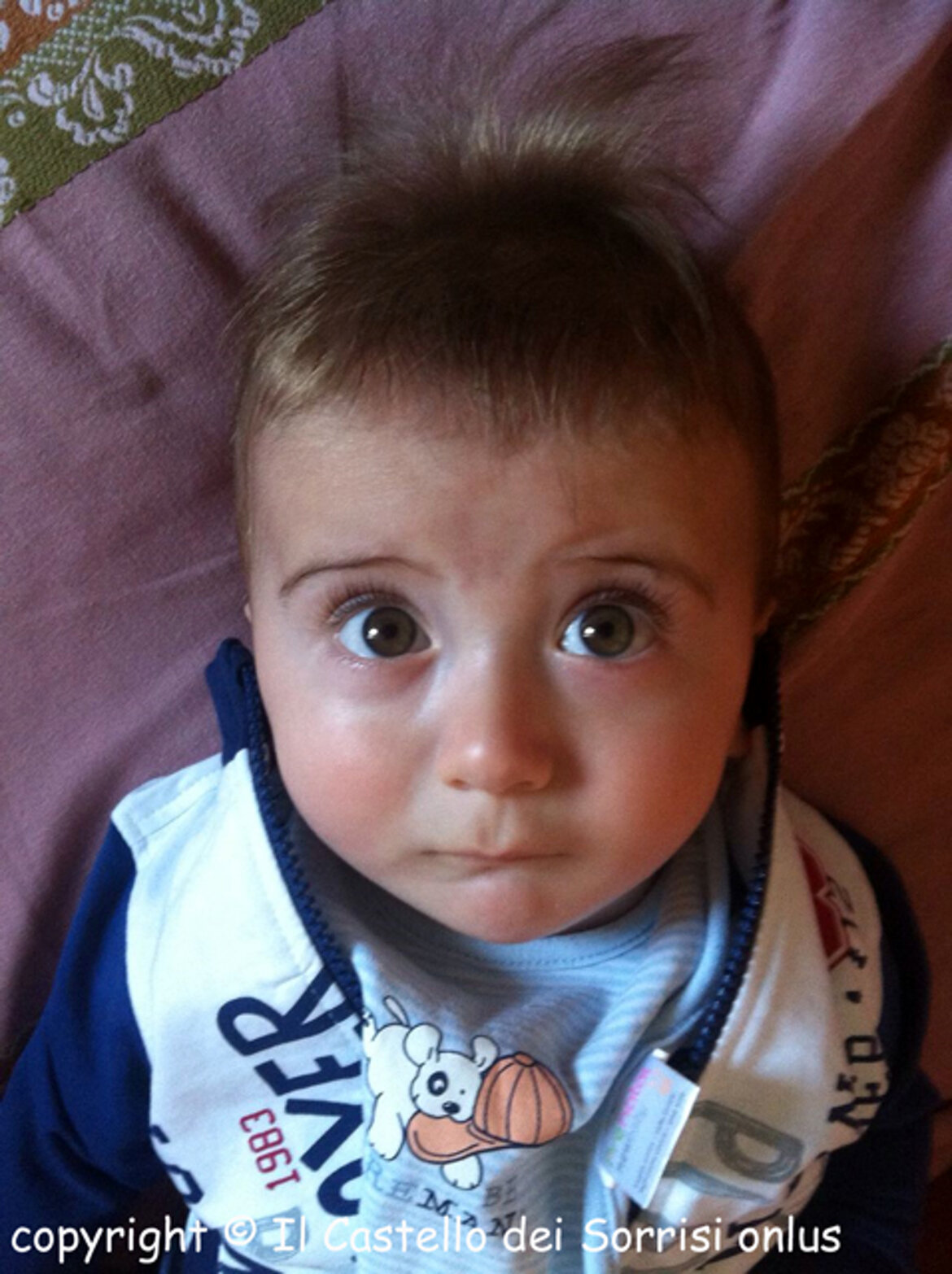 secondo controllo post-operatorio ... tutto bene !!! secondo controllo post-operatorio ... tutto bene !!!