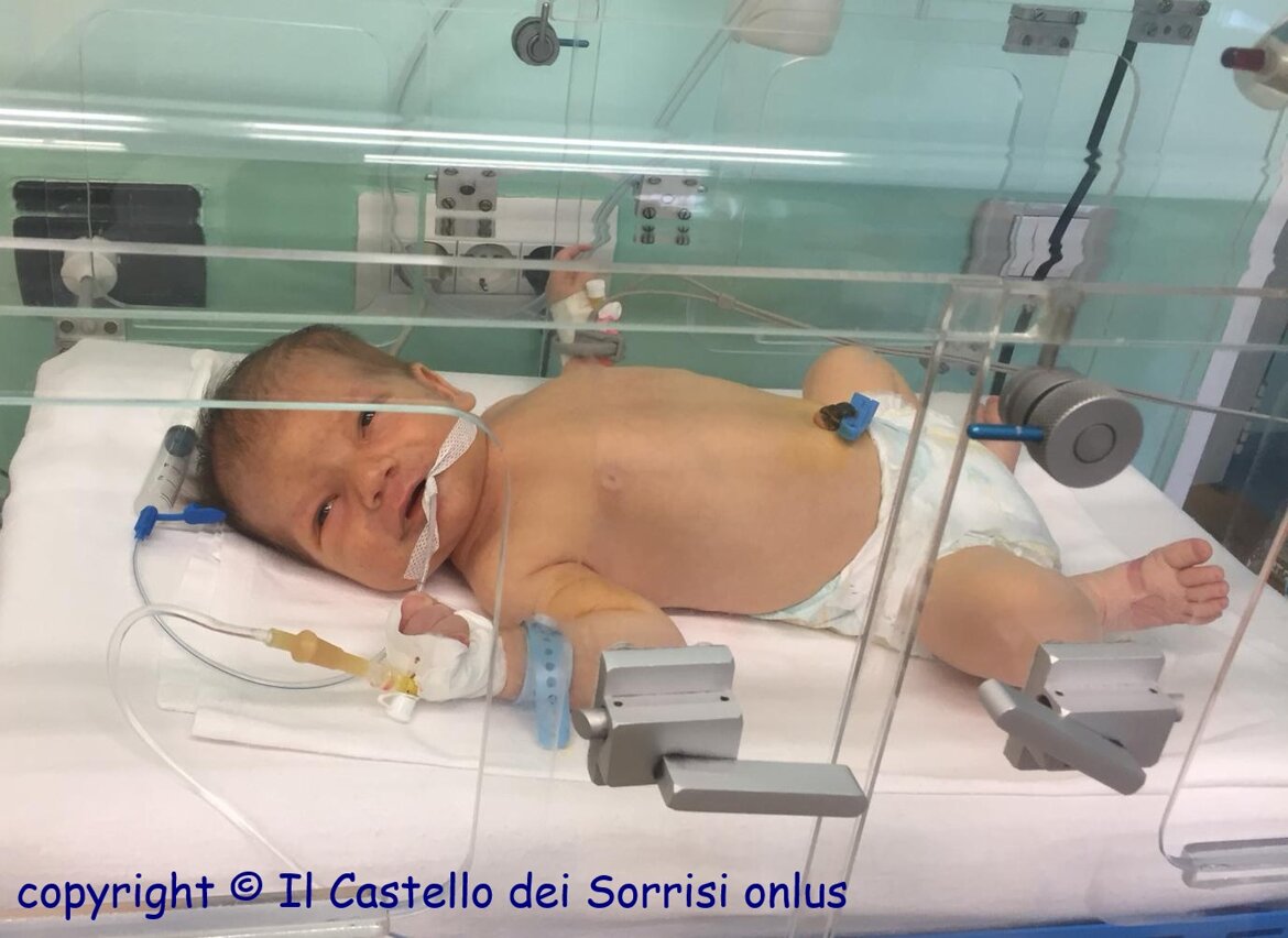 protetto in incubatrice all'Ospedale di Tirana protetto in incubatrice all'Ospedale di Tirana