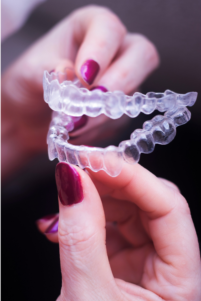 allineatori dentali trasparenti 