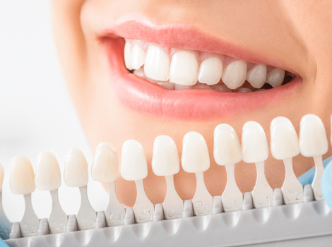 corone dentali zirconio