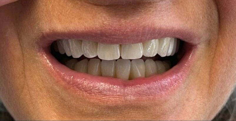 foto sorriso.jpeg foto sorriso.jpeg