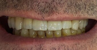 gs odontotecnica.jpeg gs odontotecnica.jpeg