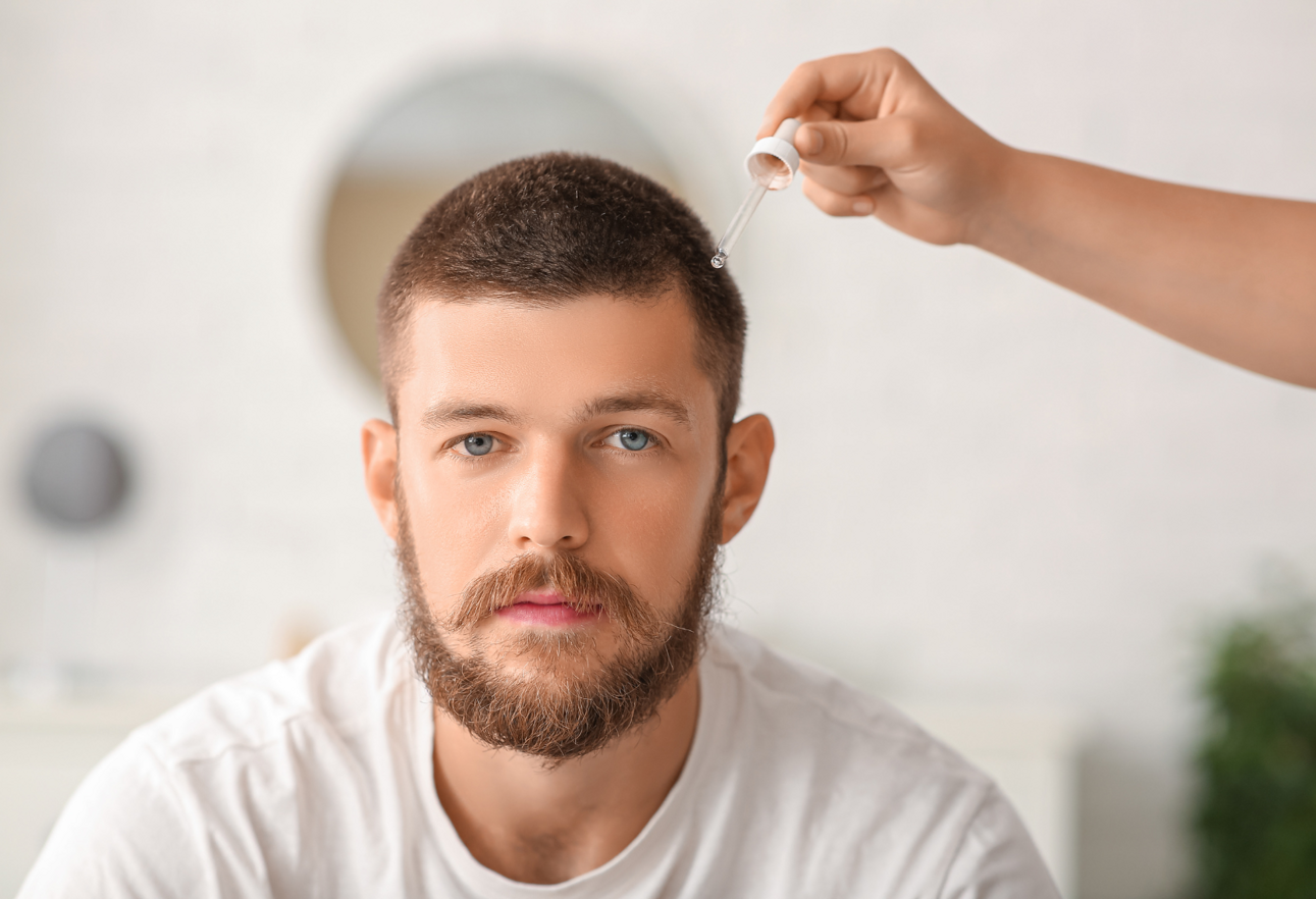 trapianto capelli cellule staminali