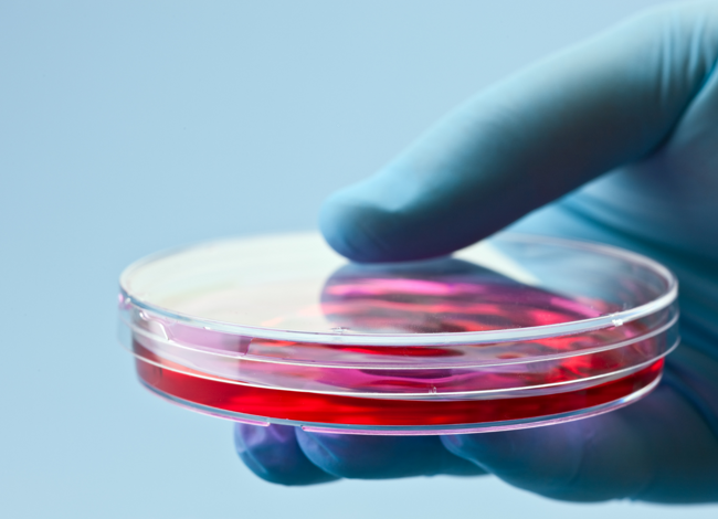 tecnica avanzata trapianto capelli