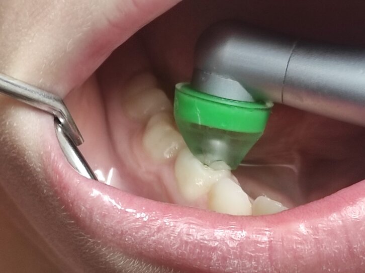 ozonoterapia-1024x766.jpeg