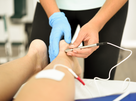 needling smagliature gambe