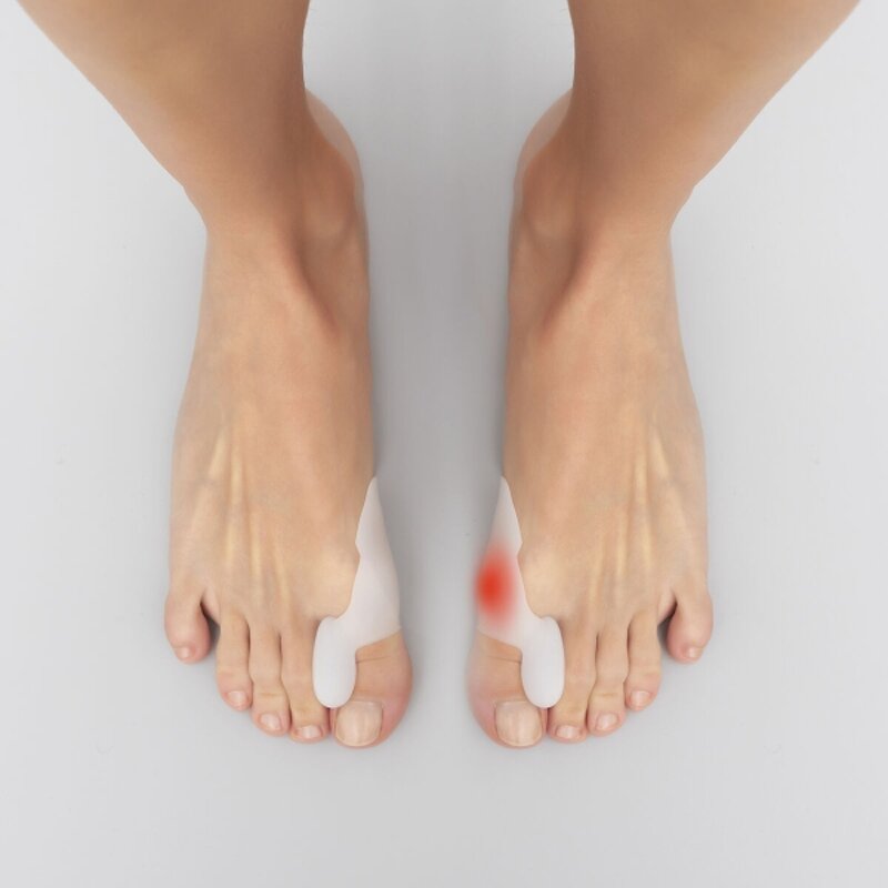 correttore-protezione-in-silicone-per-alluce-valgo-bunilief-innovagoods-2-unita