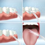 idropulsore-dentale-ricaricabile-portatile-denter-innovagoods