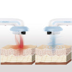 massaggiatore-anticellulite-a-cavitazione-ultrasonica-con-infrarossi-e-elettrostimolazione-3-in-1-cellymax-innovagoods