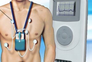 pacemaker%20.jpeg
