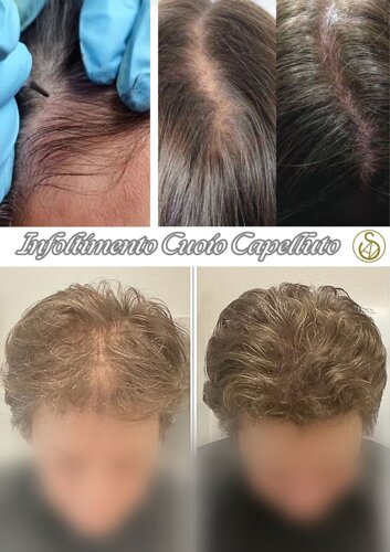 3104be450720867890f05632aeca3e0a1d611cfd