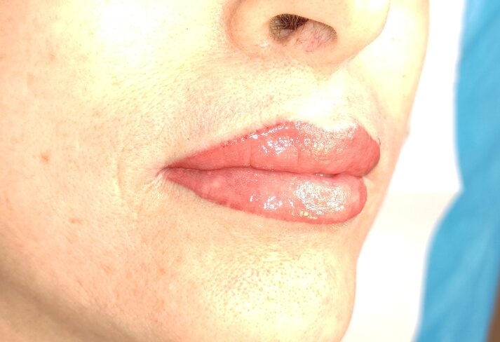 b9251070046db704348d7b6284dd33421d753ea4 b9251070046db704348d7b6284dd33421d753ea4