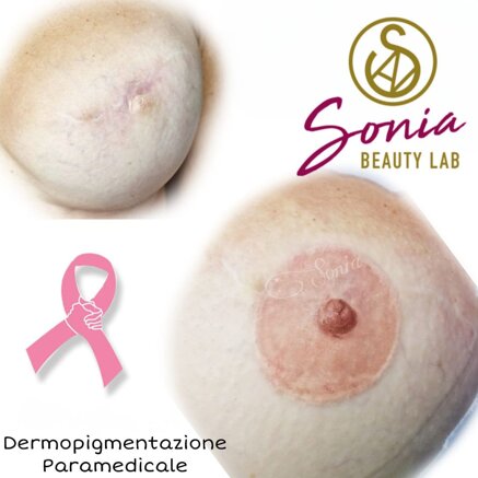 cbc2a2df0cf1a63cd7fd5f01d3753c3dd2fd731c