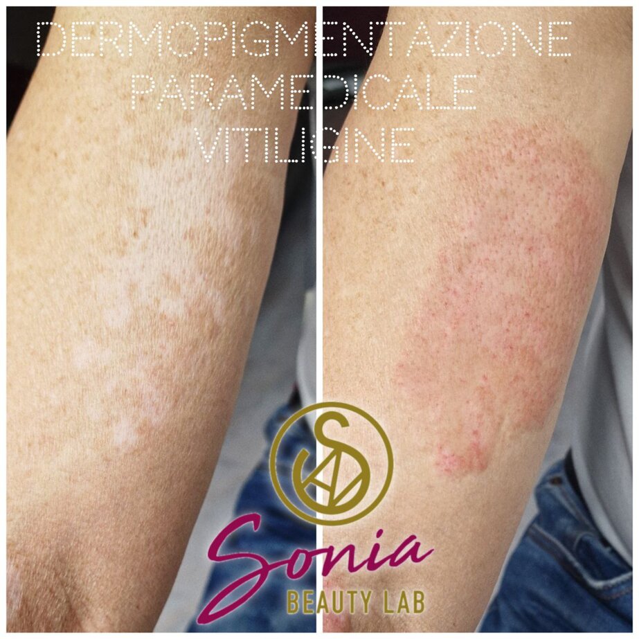 e95f340ffa271f9d1dbb6ff58abe993eb3497208