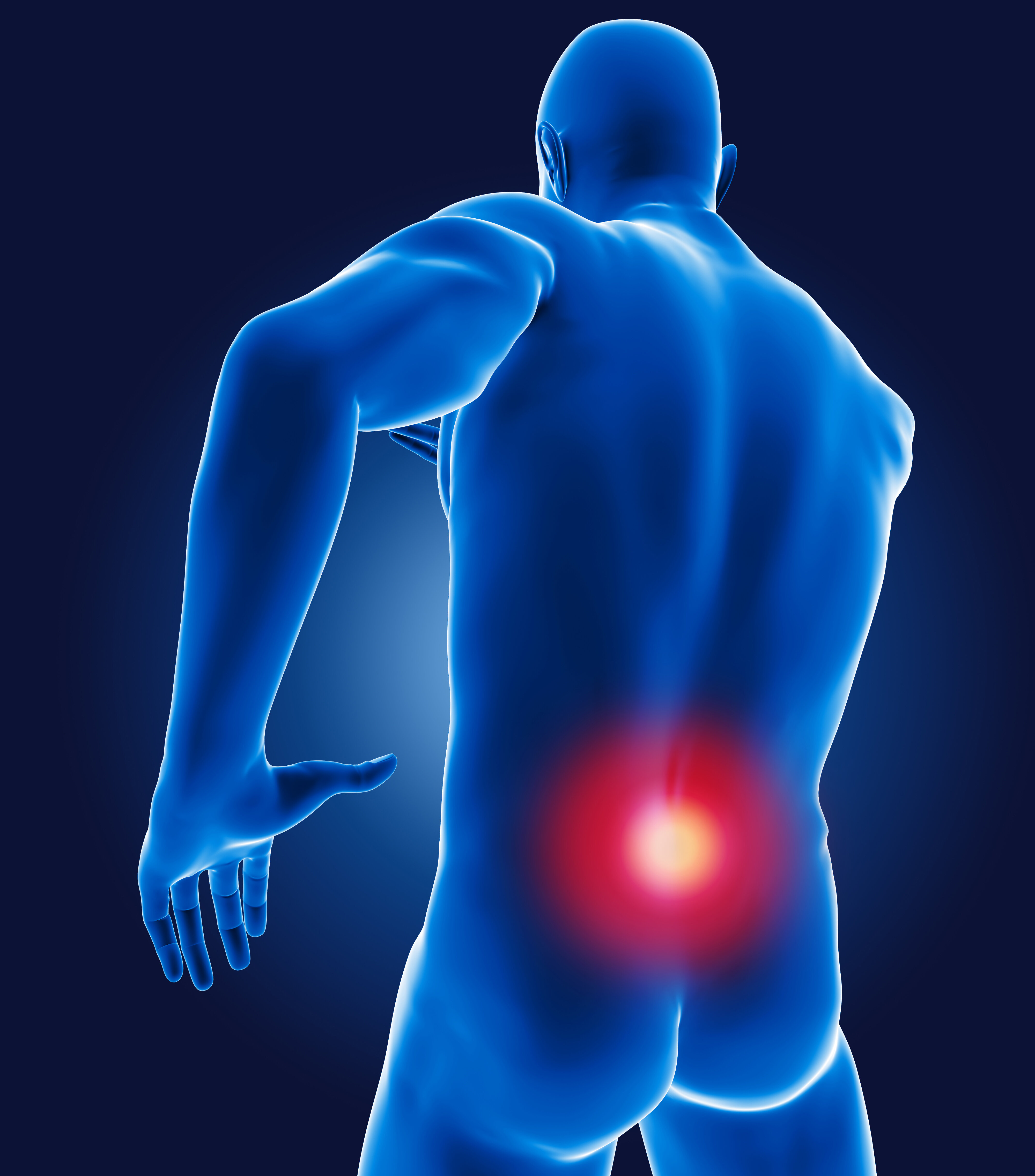 Cos’è la lombosciatalgia?