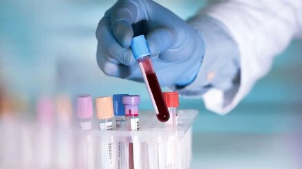 254cb472e687b6b58d9581ebb3b2da435c414d65