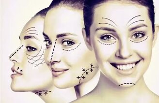 effetto lifting