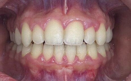 4cf964a744dee17cb74c8e04645bb54af2c7cce9 4cf964a744dee17cb74c8e04645bb54af2c7cce9