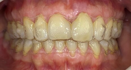 72f1673495445407a9bd9552088b1d81414b541a