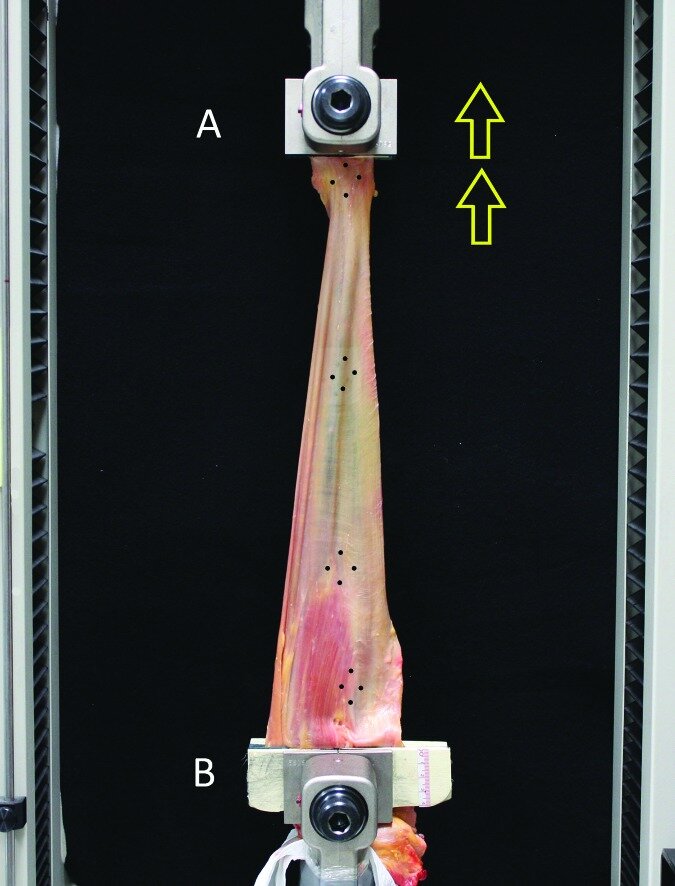bf000265fdca32b4ec57bc6c1e07403d040c627c.jpg bf000265fdca32b4ec57bc6c1e07403d040c627c.jpg