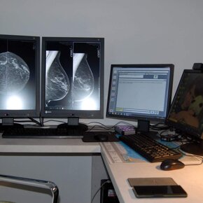 Work Station refertazione Schermi EIZO in altissima definizione per la gestione delle immagini anche in comparativa