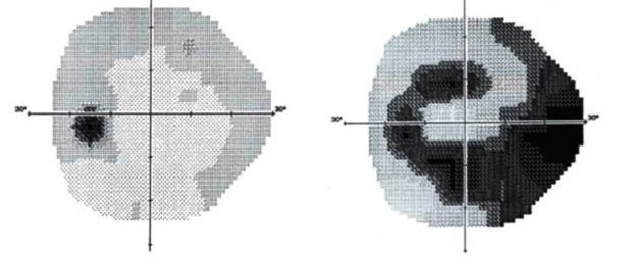 aae661dee754f4721ba9d94afd4eb92e7f318095 aae661dee754f4721ba9d94afd4eb92e7f318095