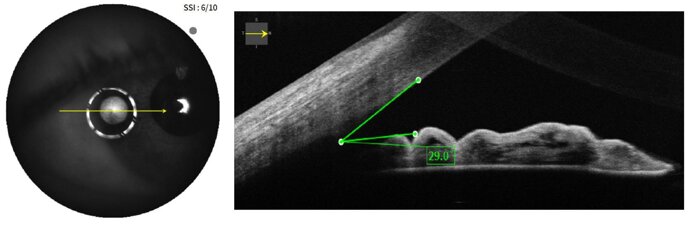 ffa572a918a2cc592f39edc7320c72861b1bfb4b