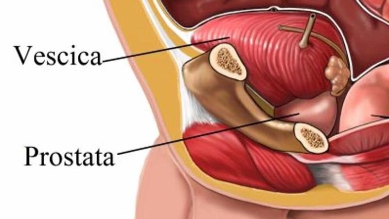 Devo fare una biopsia alla prostata. Mi devo preoccupare?