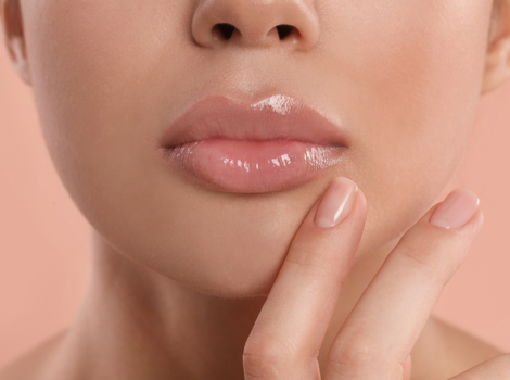 filler labbra odontoiatra estetico