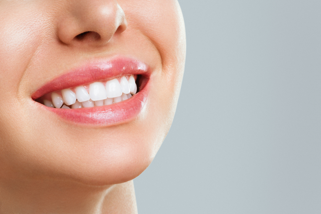 sbiancamento dentale