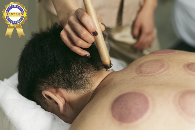 corso-di-formazione-e-uso-delle-tecniche-di-moxibustione