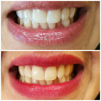 collagemaker_20170717_151555.jpeg collagemaker_20170717_151555.jpeg