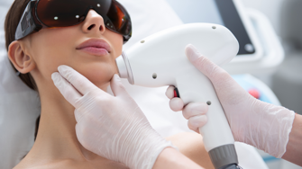epilazione laser 
