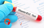 vitamina-b12