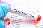 colesterolo-alto