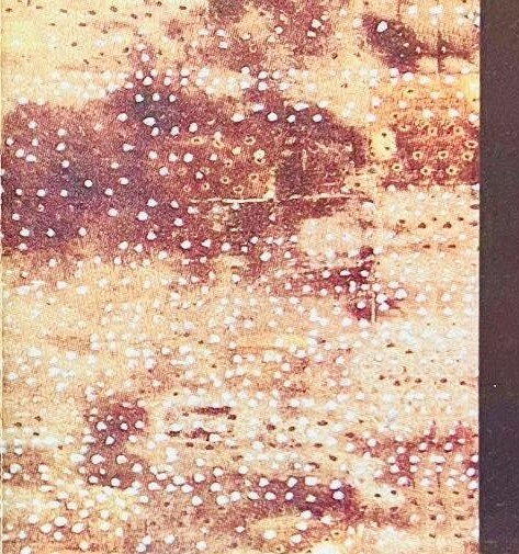 Buried Alive degli Änglagård