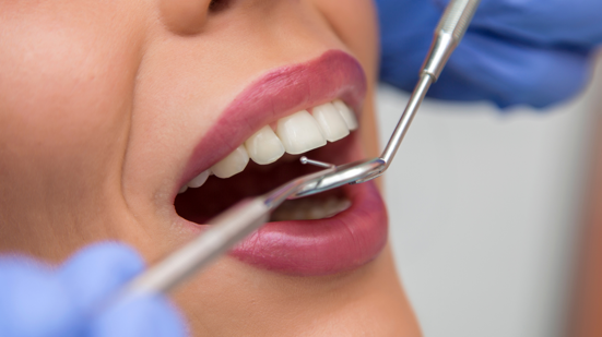 cura dei denti