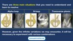 role-of-the-endoscopy-nurse-auxiliary-maneuvers