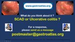 medical-quiz-scad-or-ulcerative-colitis