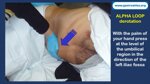 role-of-the-endoscopy-nurse-auxiliary-maneuvers